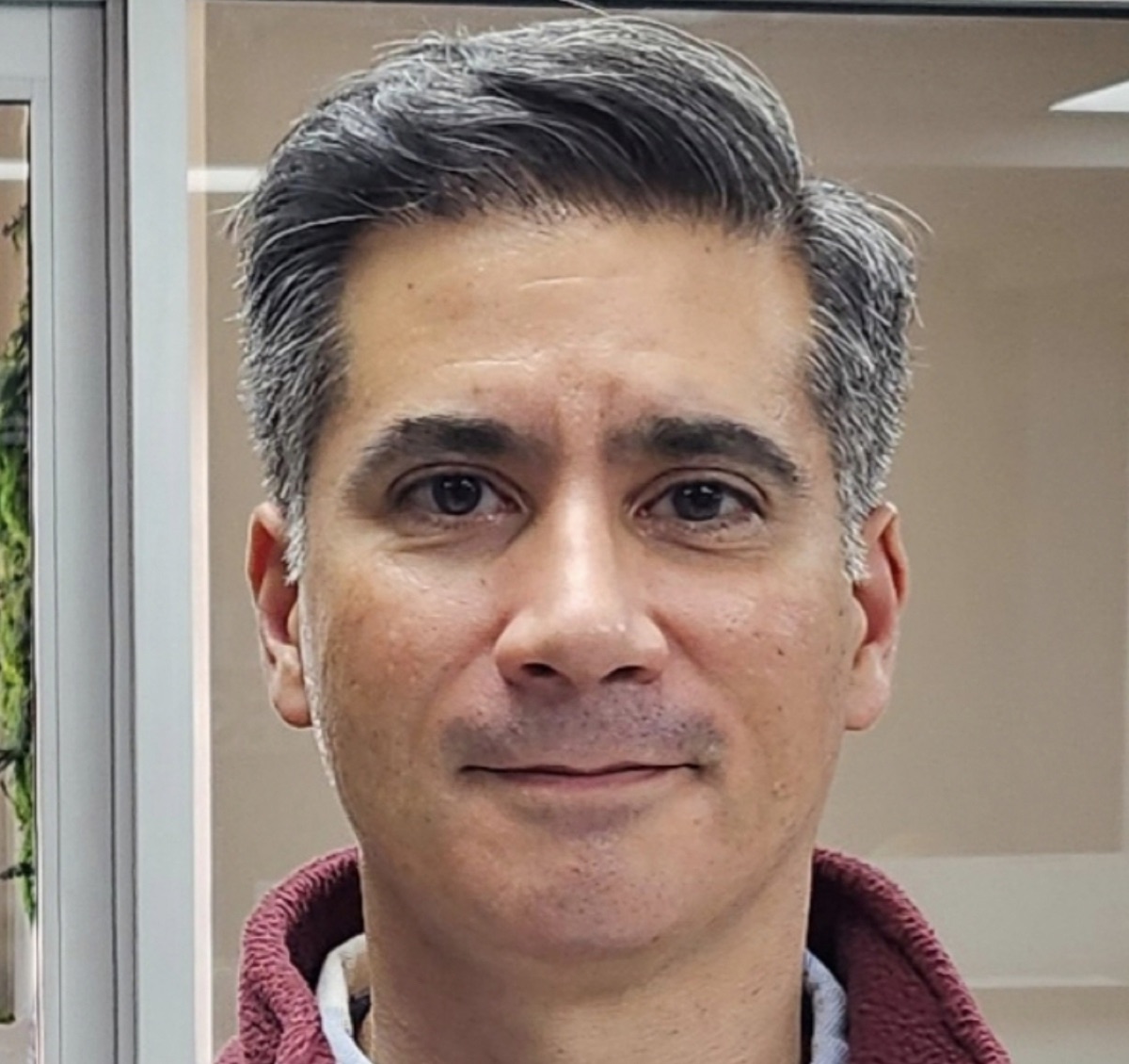 Patient 24 after hair restoration at HRA of Buffalo