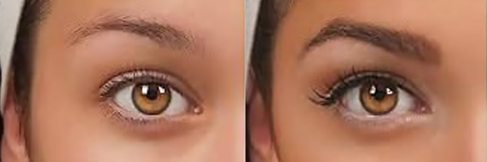 eyebrow restoration buffalo ny