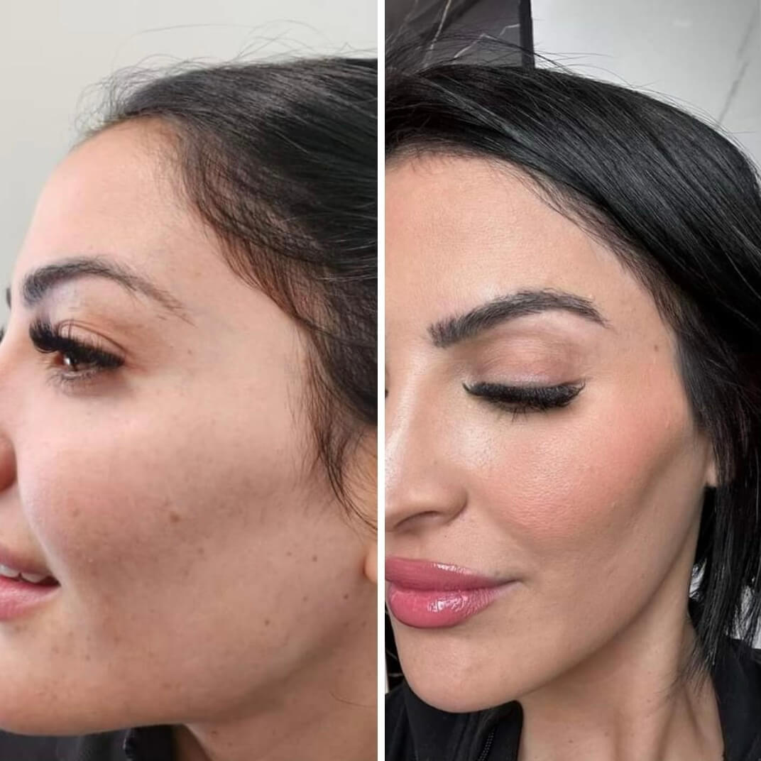 eyebrow restoration WNY